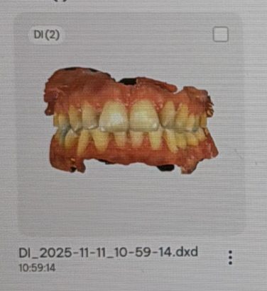 Digitaler Scan eines Kiefers auf dem Bildschirm